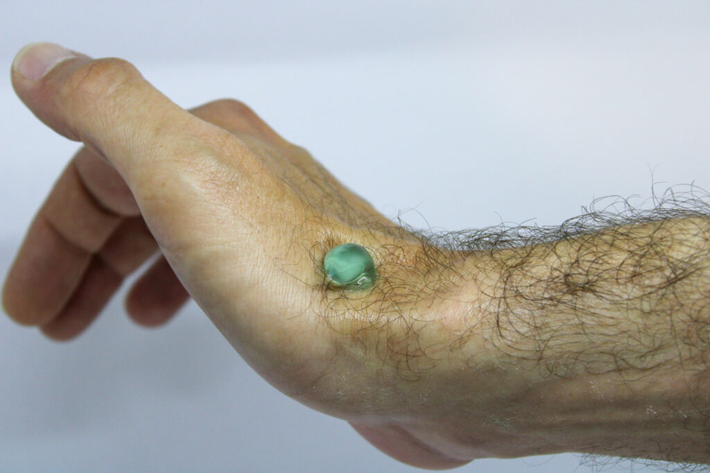 Benefits of Biofreeze Total Vitality Medical Group