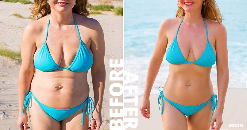 Semaglutide Weight Loss Semaglutide Diet