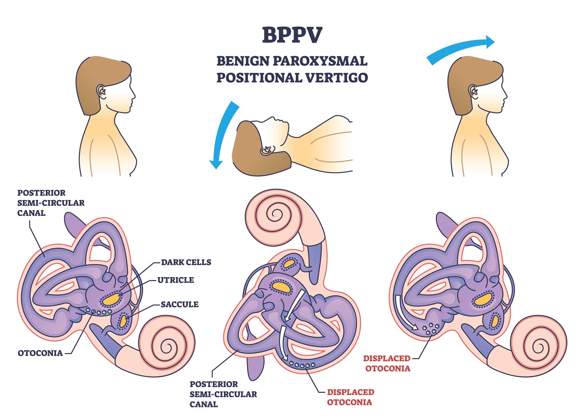 understanding vertigo